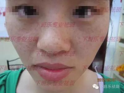 記者采訪下班樂創始人楊惠馨是如何祛斑的經過-時尚頻道-手機