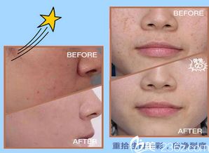 郄美芳——蘇州姑蘇區(qū)醫(yī)顏美佳網(wǎng)專業(yè)祛斑專家